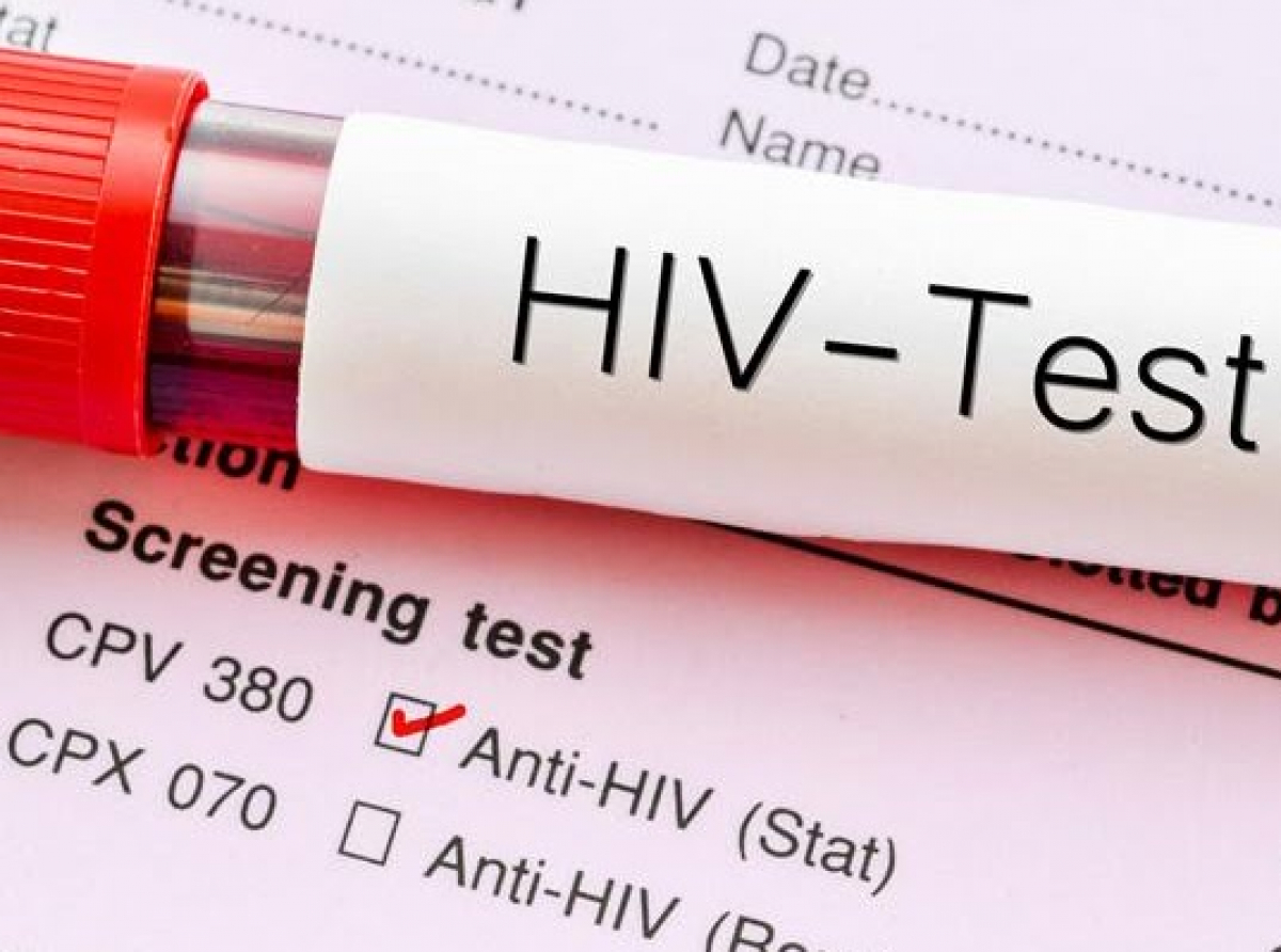Ευρώπη: Ανακαλύφθηκε μία νέα, πιο παθογόνα και μεταδοτική, παραλλαγή του ιού HIV του AIDS