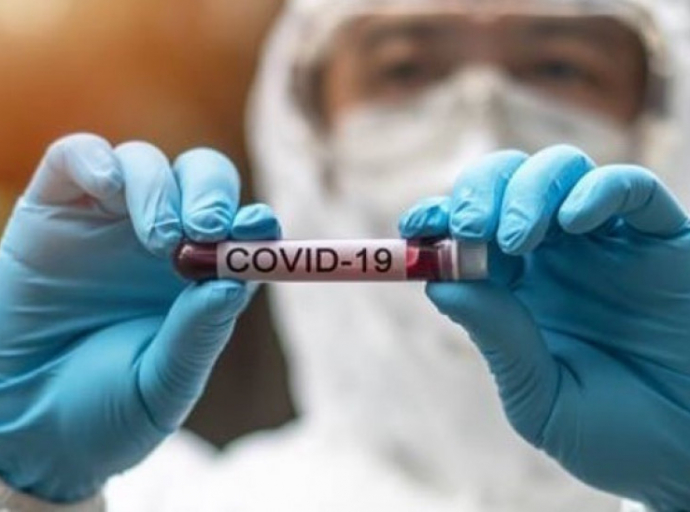  121 νέα κρούσματα COVID-19 σήμερα στη Κύπρο 