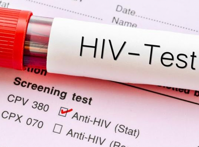 Ευρώπη: Ανακαλύφθηκε μία νέα, πιο παθογόνα και μεταδοτική, παραλλαγή του ιού HIV του AIDS